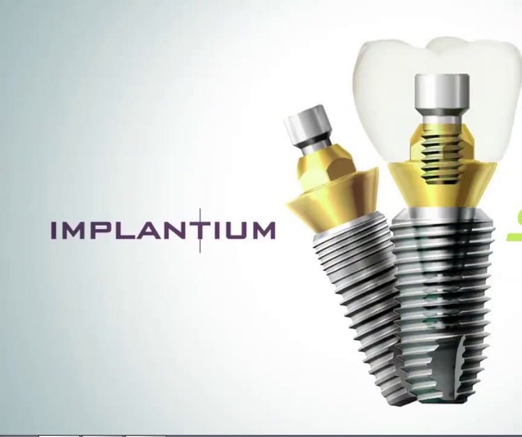 Имплантация зуба Implantium