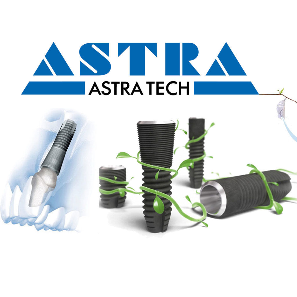 Имплантация зуба Astra tech